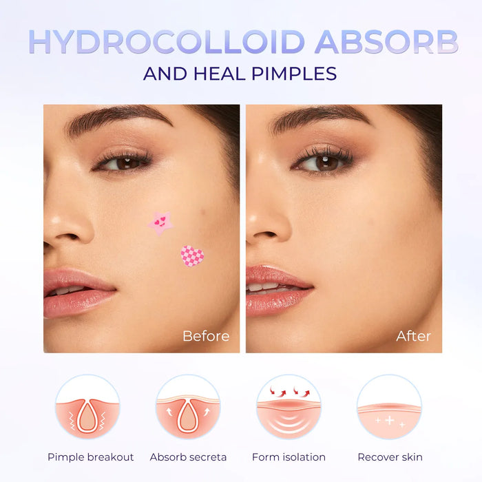 SACE LADY Multi-Shaped Pimple Patches - product image 3