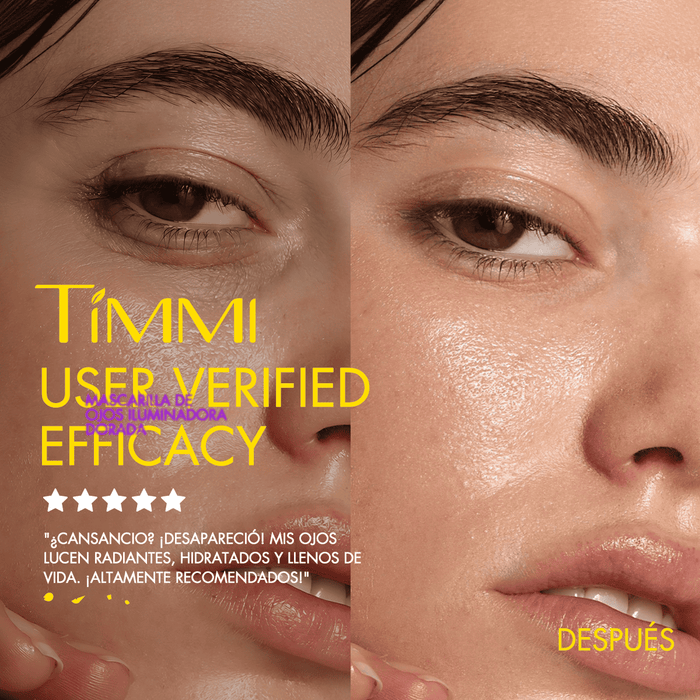 Before-and-after under-eye appearance with TIMMI Beauty Golden Glow Eye Mask